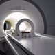 A magnetic resonance imaging machine. MRI scans are used to customize the brain stimulation to the patient.